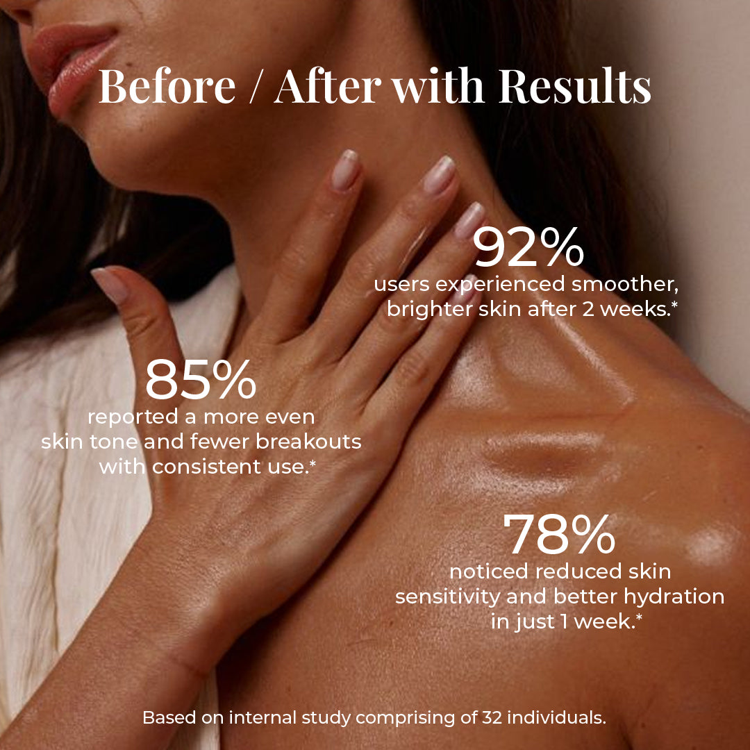Woman touching shoulder with text showing percentages about smoother, brighter skin, improved hydration, and reduced sensitivity.
