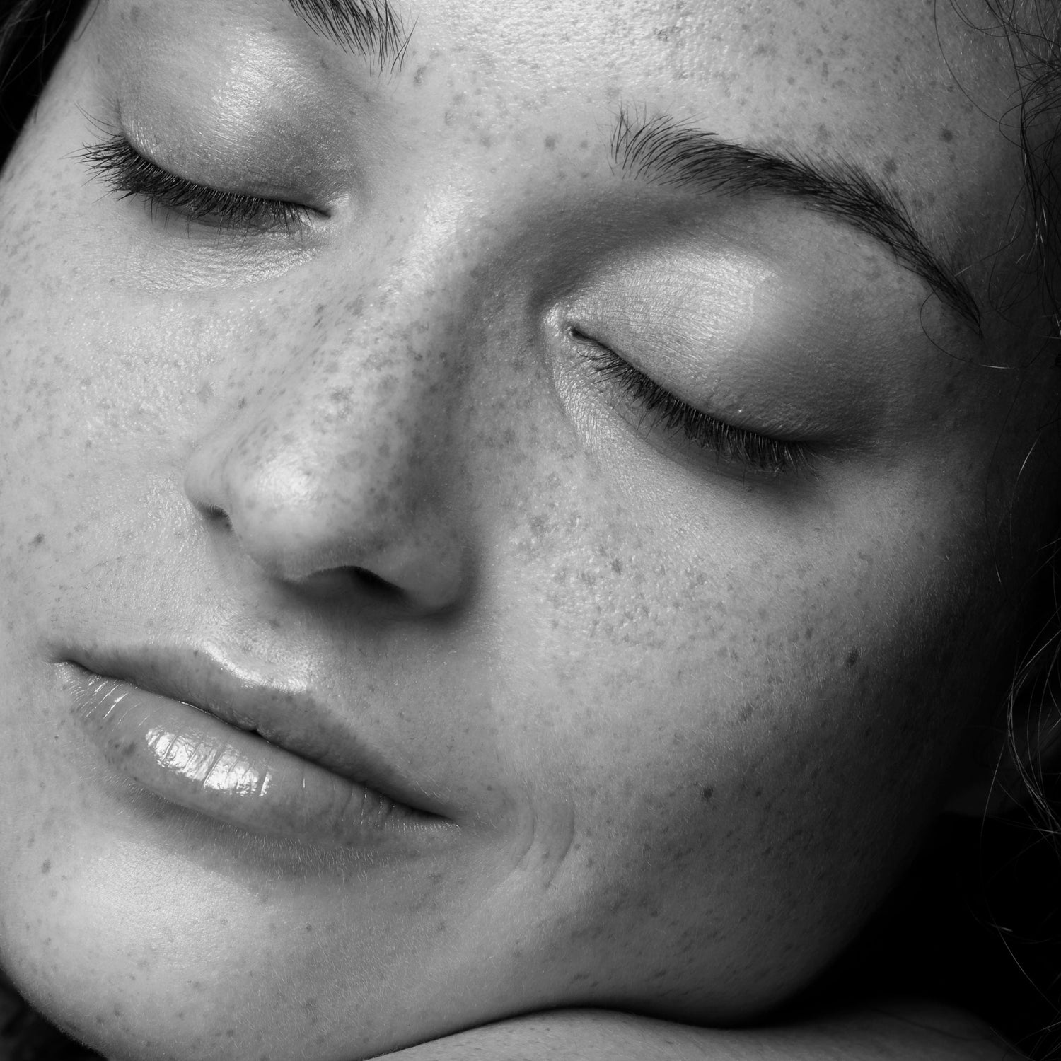 Dark Spots &amp; Pigmentation