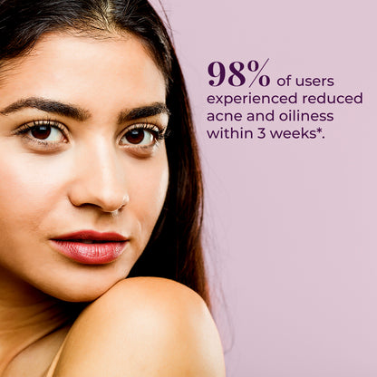 Close-up of a young woman with clear skin, representing effects of JiViSa- Nimba Tulsi facial Ubtan. To the right of her face, text states 98% of users experienced reduced acne and oiliness within 3 weeks*. The background is a soft.