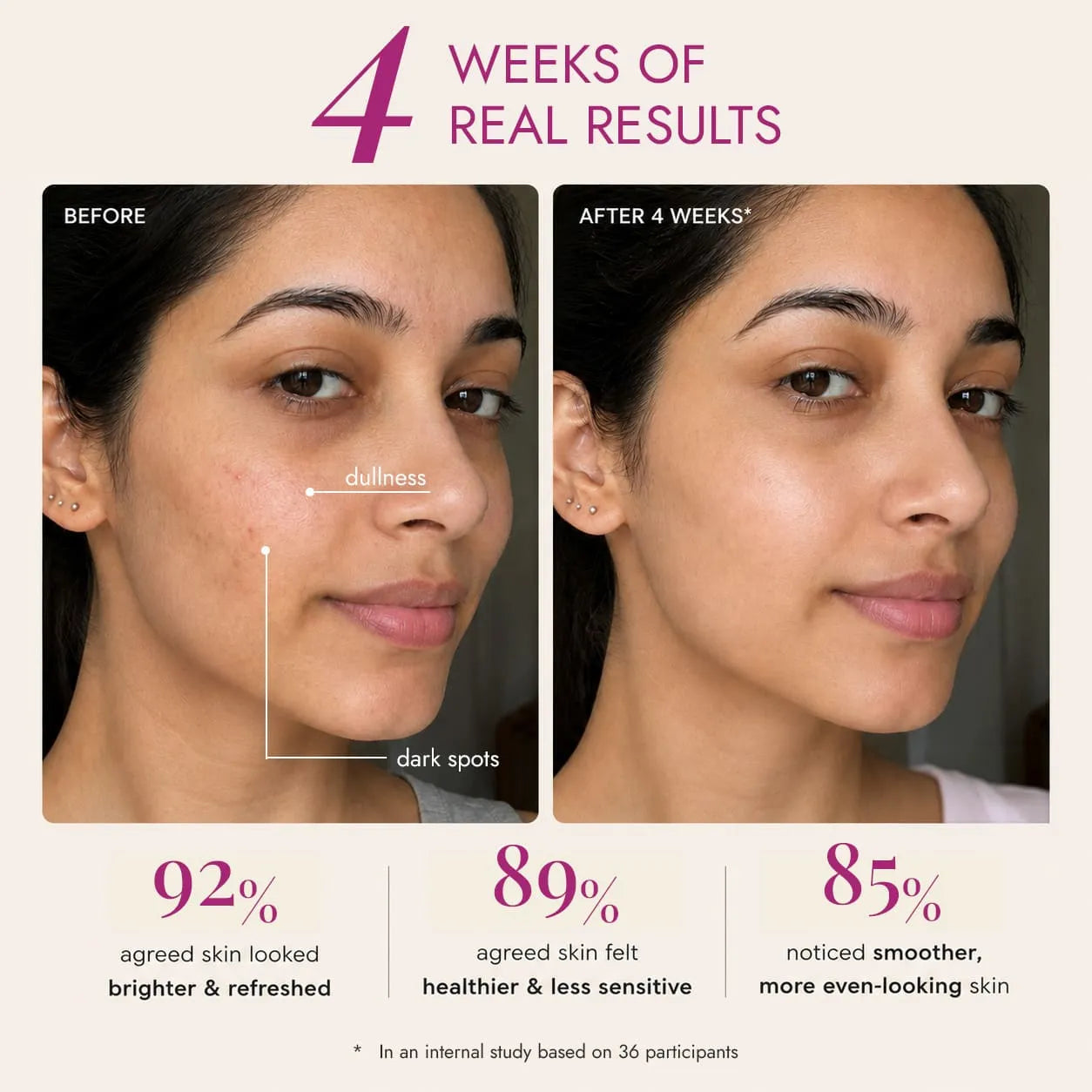 Before and after 4 weeks using Kesara Illume Brightening Face Cream – reduced dullness and dark spots, 92% saw brighter skin.