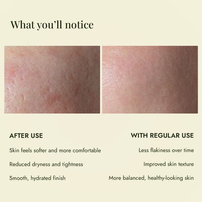 Skin before and after JiViSa Kumari Elaichi Ubtan help reduce dryness and tightness for a smoother, hydrated finish