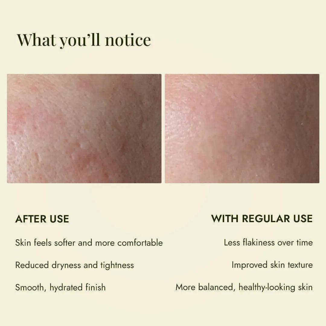 Skin before and after JiViSa Kumari Elaichi Ubtan help reduce dryness and tightness for a smoother, hydrated finish