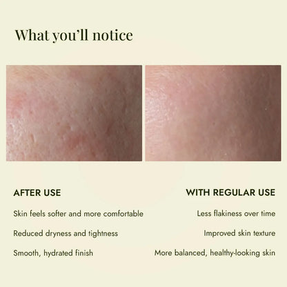 Skin before and after JiViSa Kumari Elaichi Ubtan help reduce dryness and tightness for a smoother, hydrated finish