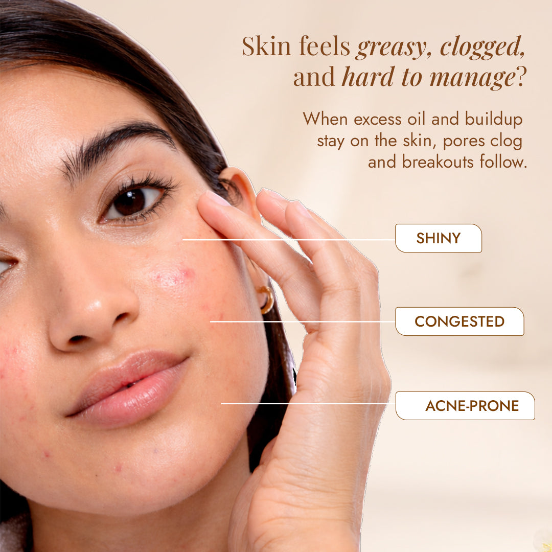 Shiny, congested, acne-prone skin from excess oil and buildup — JiViSa Nimba-Tulsi Ubtan helps reset oily, breakout-prone skin